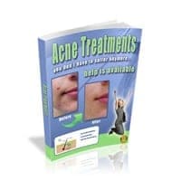¡Tratamientos de acné!
